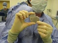 Used Pacemakers Help Poor Heart Patients